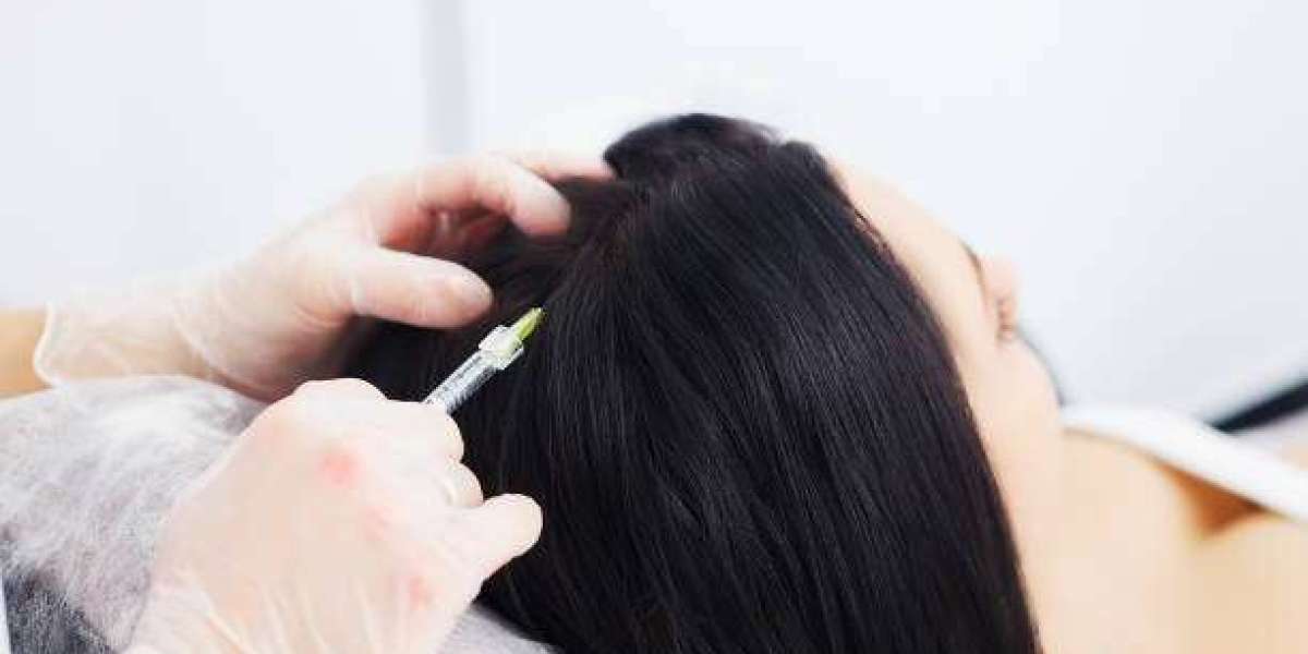 PRP Hair Treatment for Long Lasting Hair Regrowth