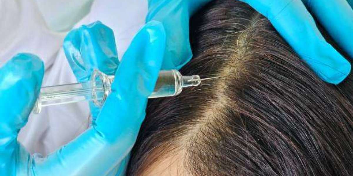 Magellan Plasma for Natural Collagen Stimulation and Renewal