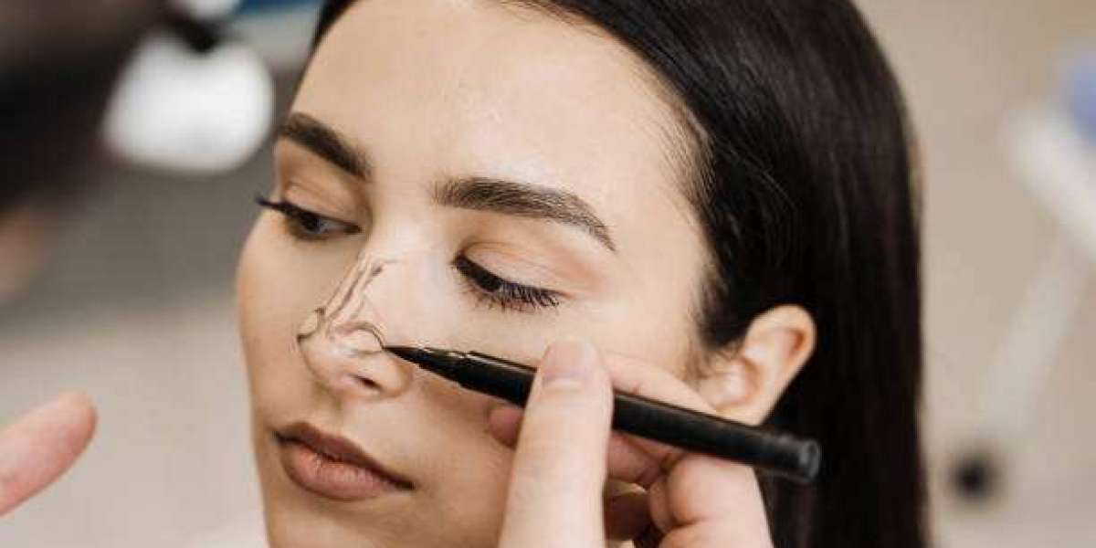 Discover the Art of Elegant Nostril Refinement