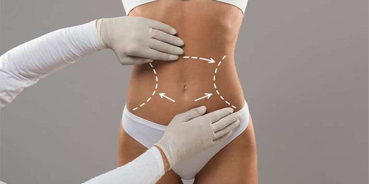 How Modern Technology is Revolutionizing Liposuction