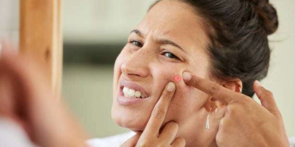 What Makes Cystic Acne Hard to Treat?