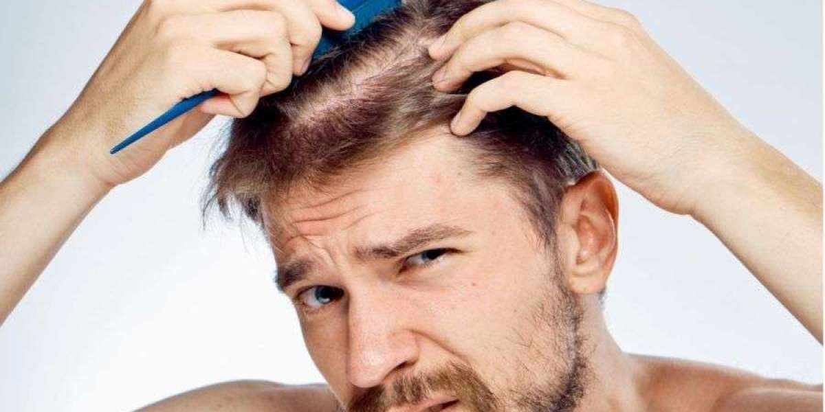 How to Care for Your Scalp After Transplant?