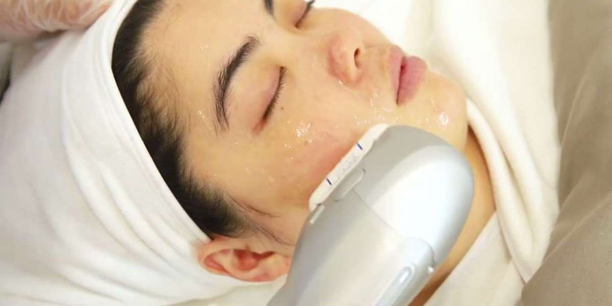 Hifu treatment in dubai anti aging benefits guide