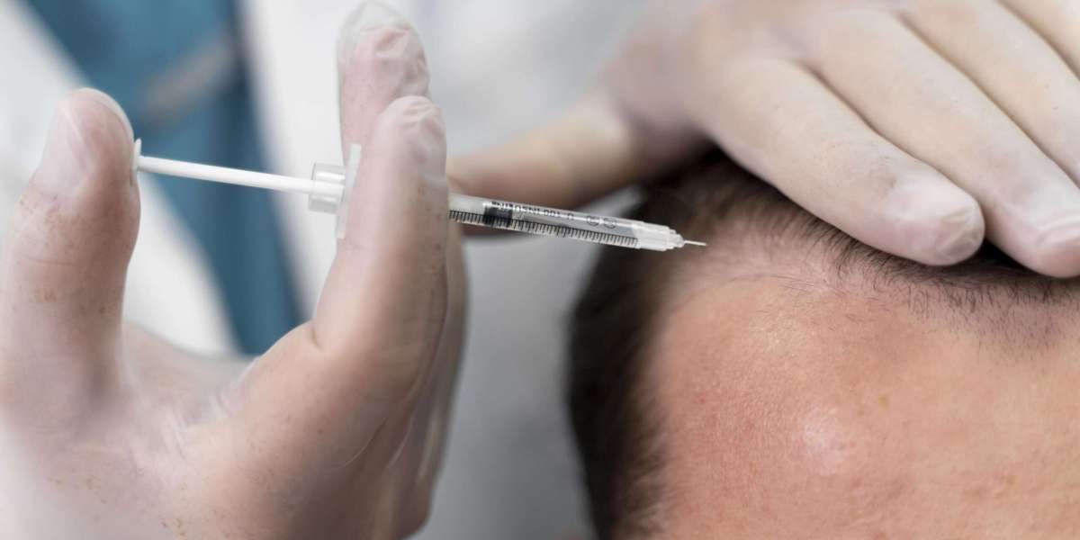 Exosomes Hair Therapy in Dubai for Healthy Scalp