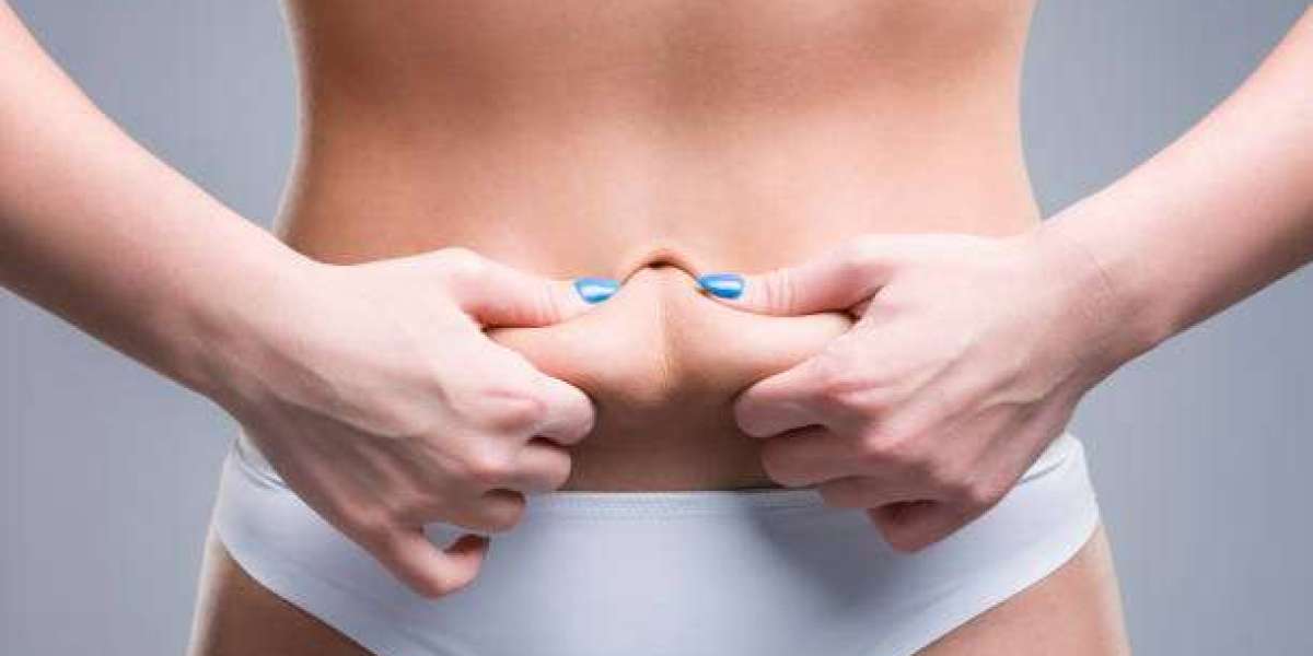 What Preparation Steps Precede Tummy Tuck?