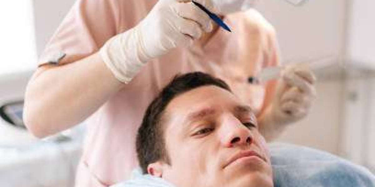 Comprehensive Guide to Hair Transplant Procedures in Riyadh