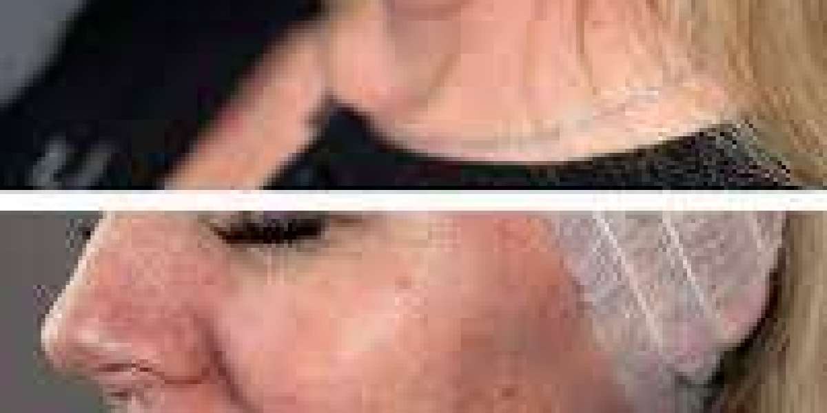 Article Picture