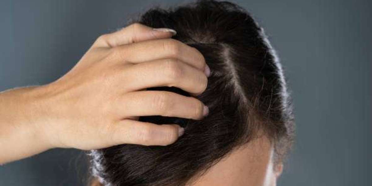 Exosomes Therapy for Hair Loss and Healthy Scalp Support