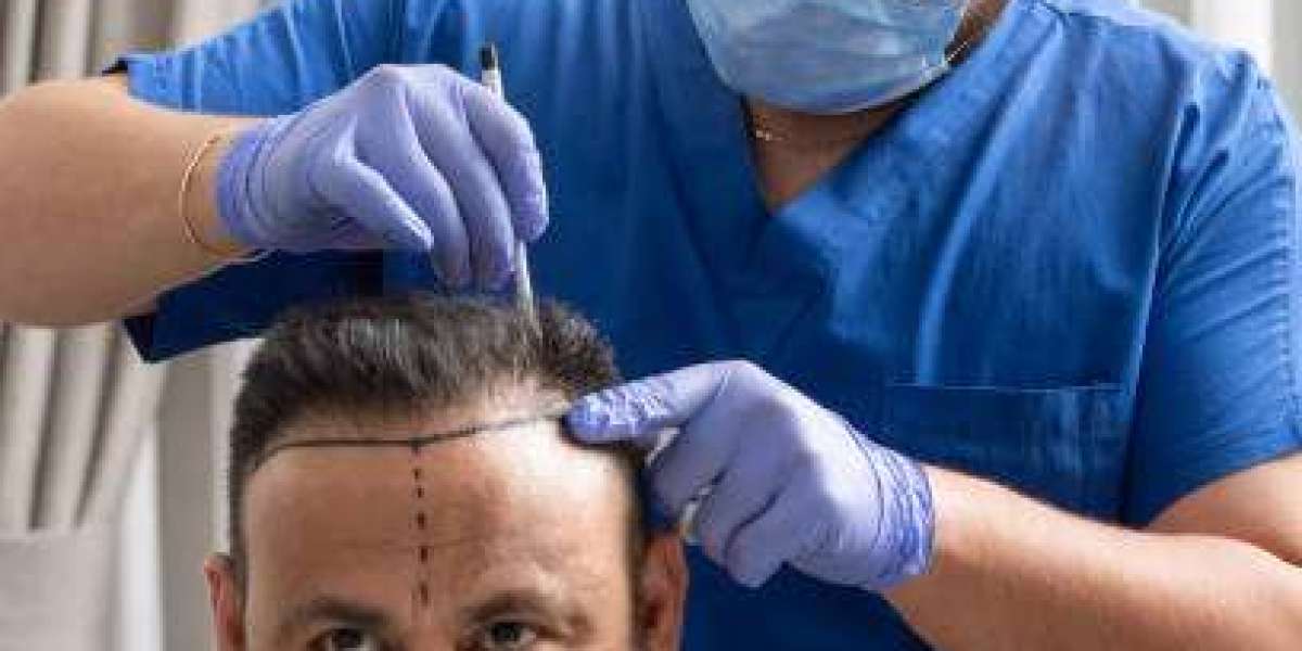 Post-Transplant Care Tips for Optimal Results in Riyadh