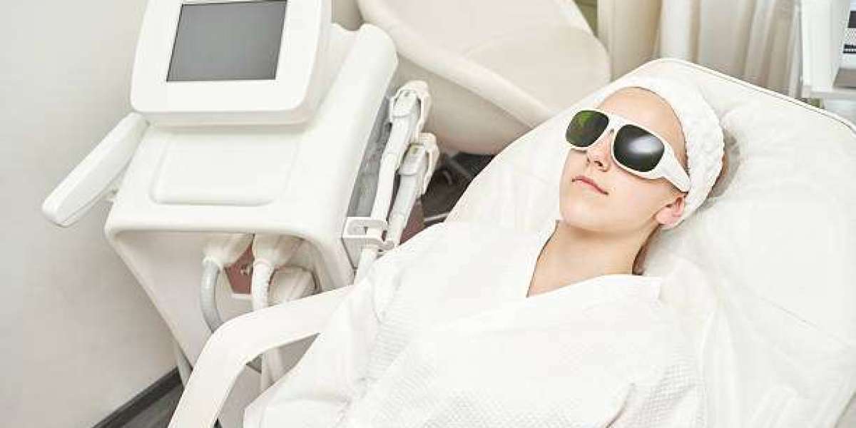 How Q-Switch Laser Helps in Minimizing Skin Discoloration in Riyadh