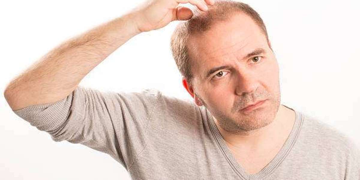 How Realistic Goals Affect Hair Transplant Cost Decisions
