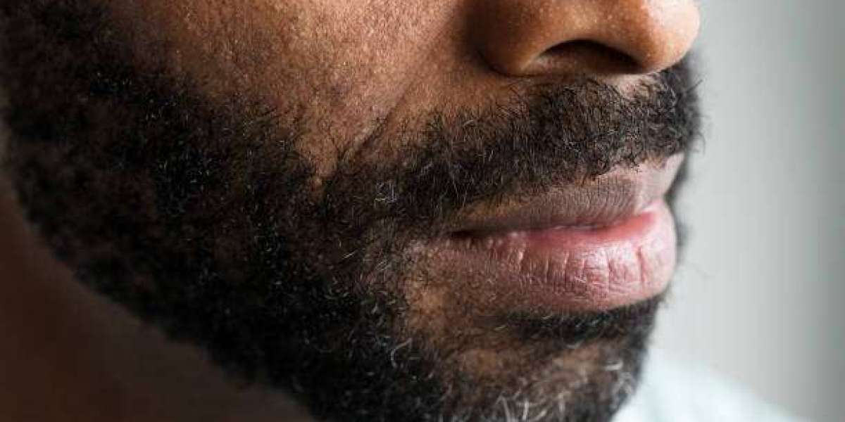 Smoker’s Lips Treatment for Reviving Dark and Dull Lips Safely