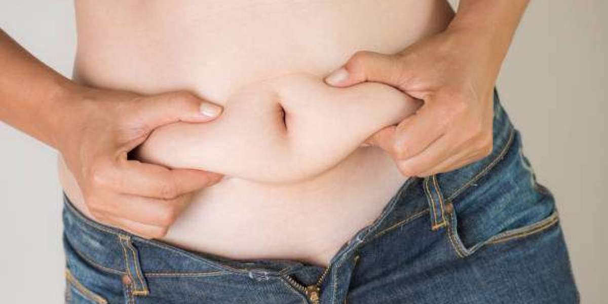 How Non Invasive Fat Removal Targets Stubborn Fat Areas