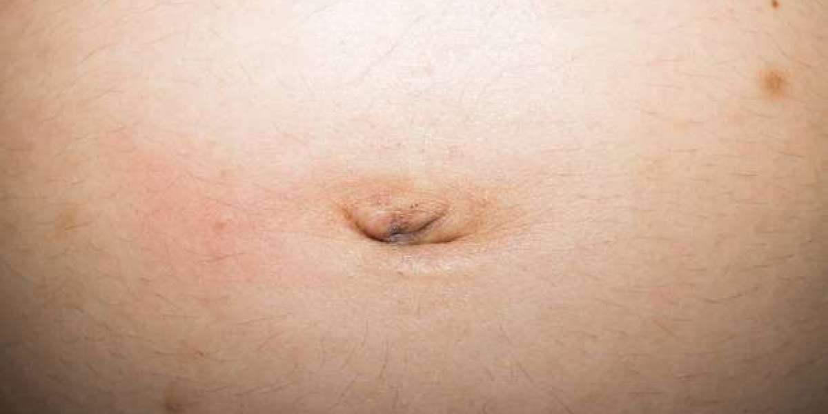 Important Insights Into Hernia Surgery Cost and Care