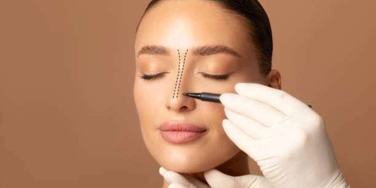 Rhinoplasty Anesthesia Choices and What Patients Experience
