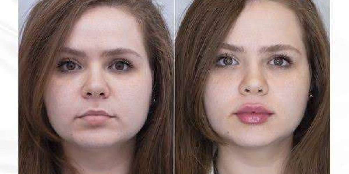 Article Picture