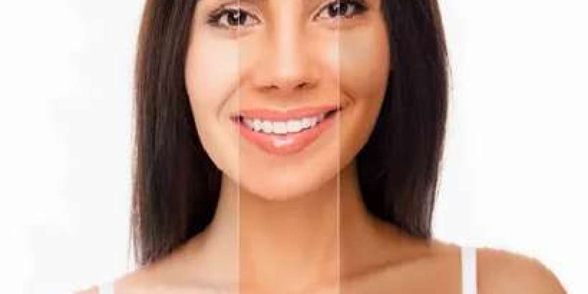 Skin Whitening in Dubai: Modern Medical Approaches