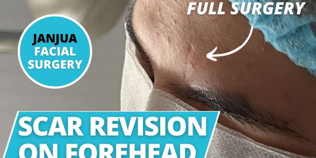 Surgical Scar Revision in Riyadh: The Psychological Benefits of Aesthetic Improvement
