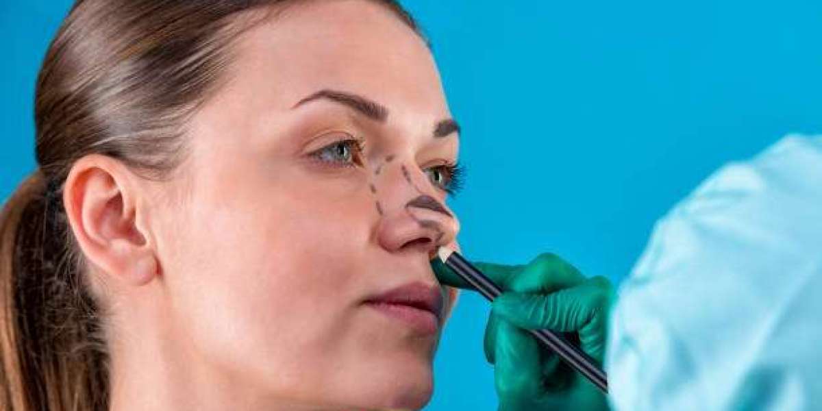 Article Picture