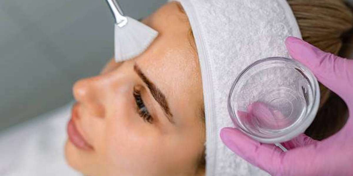 Chemical Peels to Achieve a Smooth and Clear Complexion