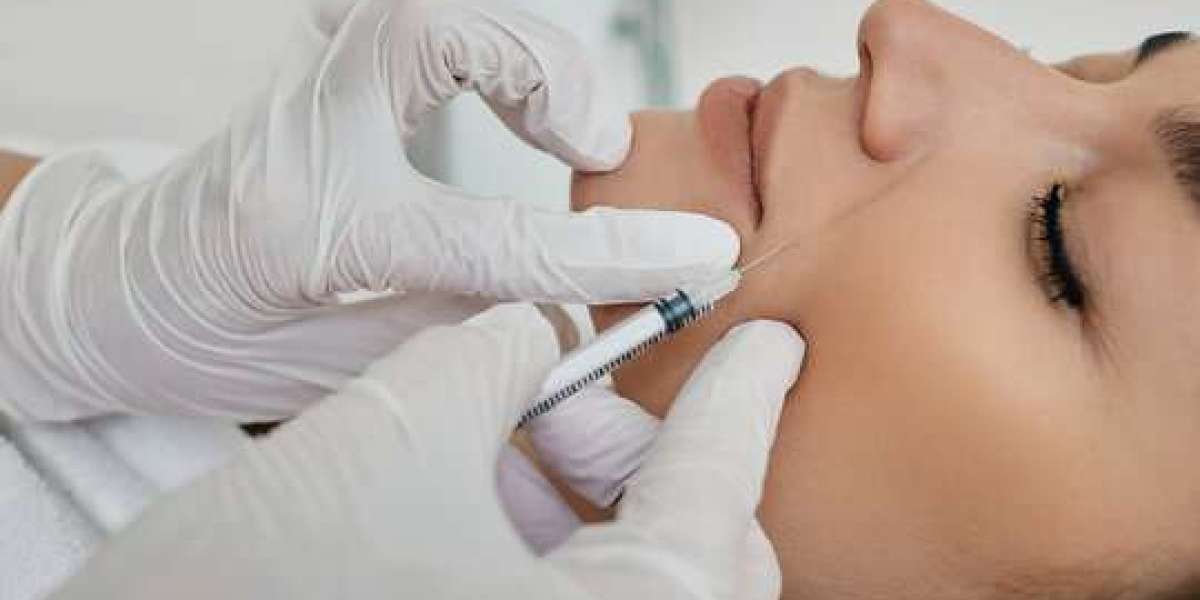 Benefits of Nasolabial Fold Filler in Dubai Explained