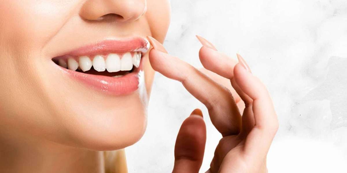 Best Dental Veneers in Dubai for Confident Smiles