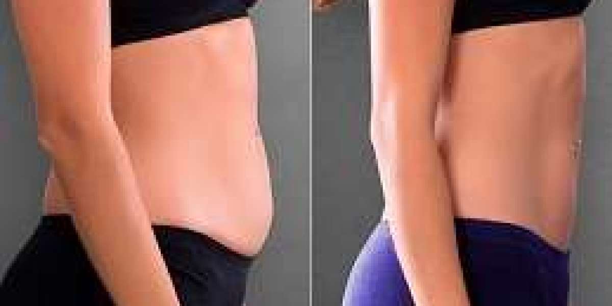 Slimming Treatment in Jeddah: A Modern Approach to Healthy Weight Loss and Body Contouring