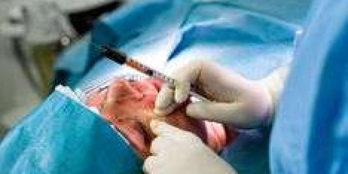Everything You Need to Know About Fat Transfer Surgery in Dubai | Complete Guide