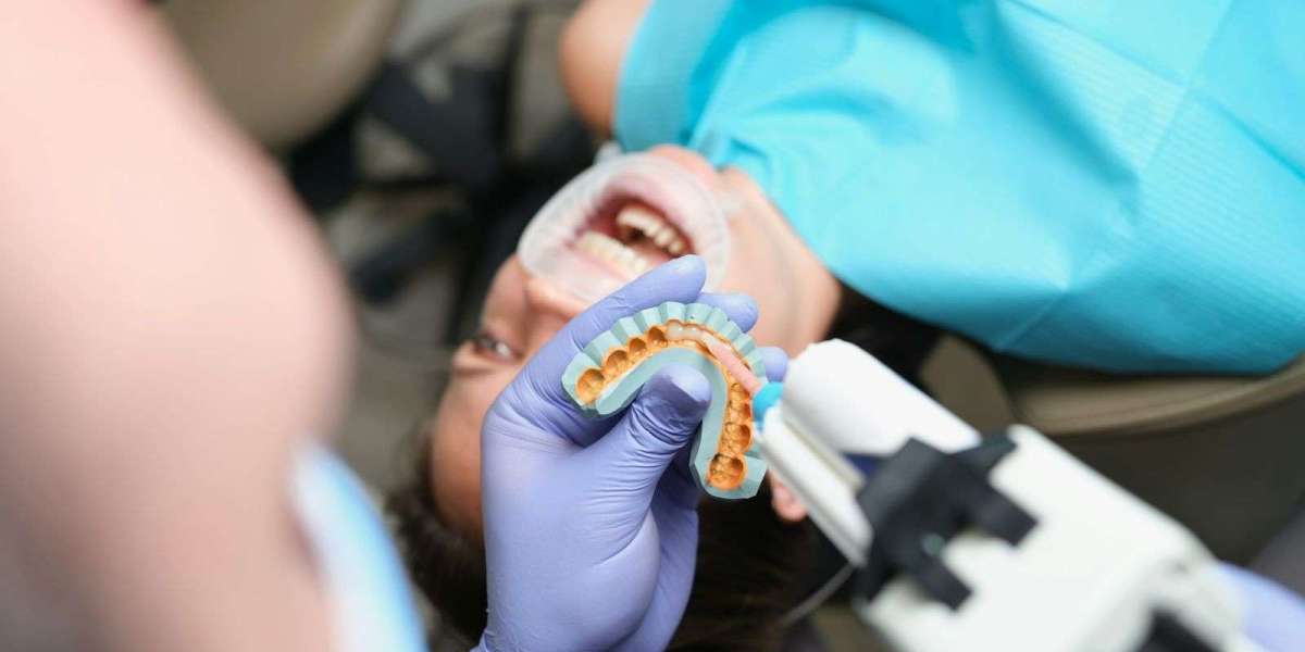 Best Dental Veneers for Long-Lasting Results