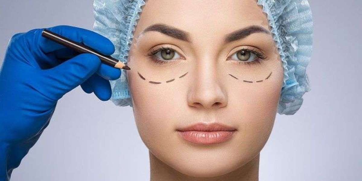 Best Under Eye Fillers Experts in Dubai