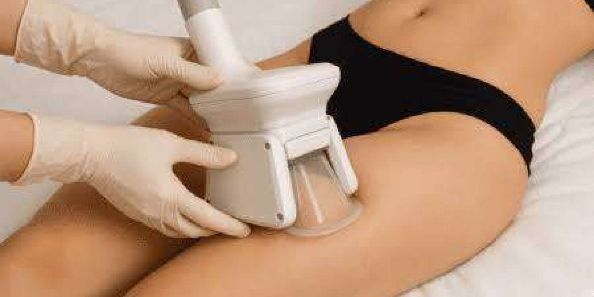 CoolSculpting Fat Freezing in Dubai | Treatment Areas