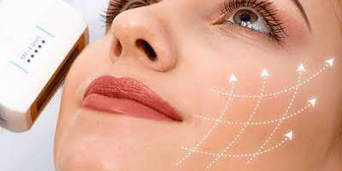 HIFU Treatment in Dubai | Non-Surgical Skin Tightening