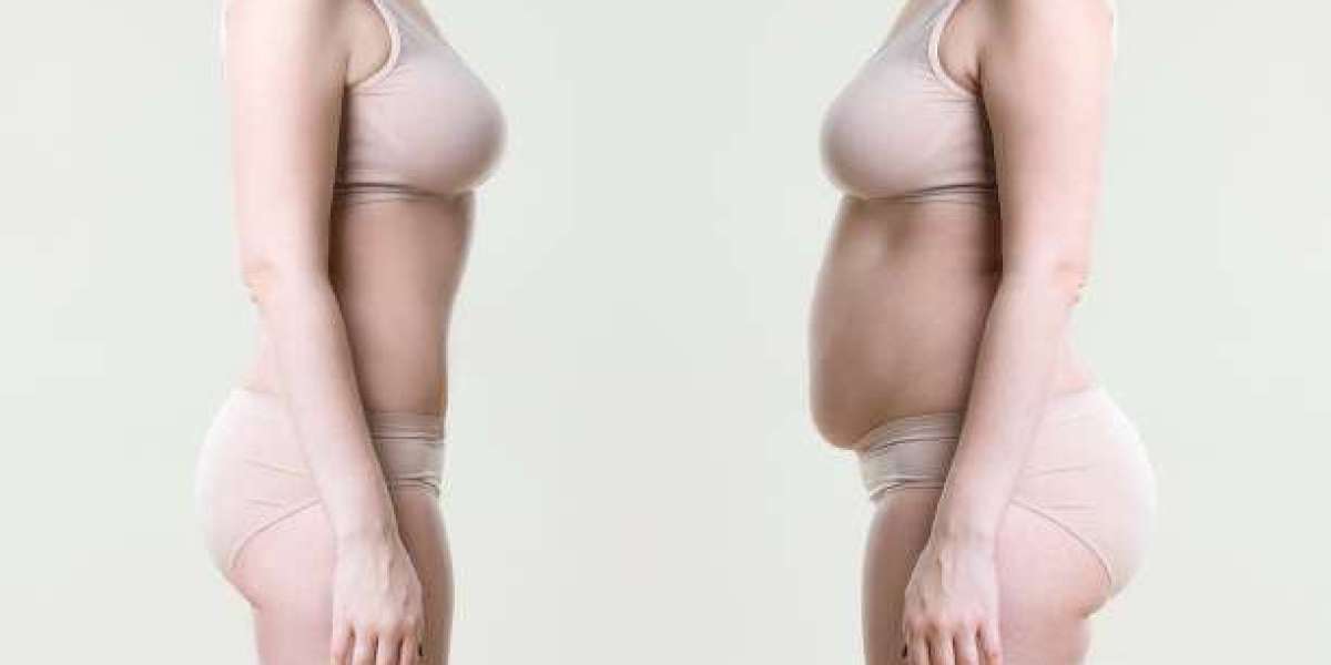 Expert Care for Mommy Makeover in Riyadh and Natural Body Restoration