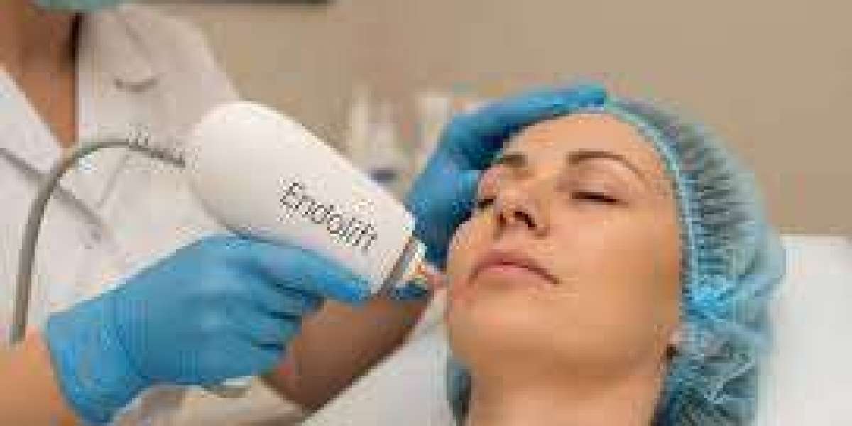 Endolift Treatment in Dubai | Benefits & Recovery