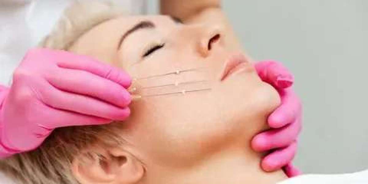Thread Lift in Dubai: Advanced Aesthetic Options for Facial Support