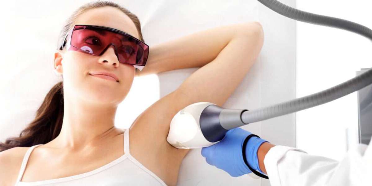 Laser Hair Removal in Dubai: Who Is It For?