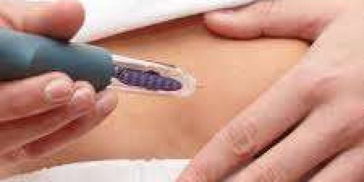 Expert Fat Melting Injections in Riyadh for Natural Looking Results