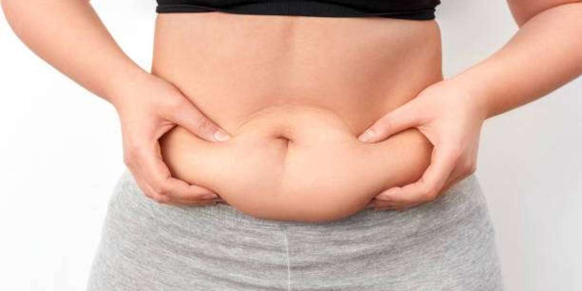 Why Increasing Numbers Are Choosing Liposuction in Riyadh for Body Contouring