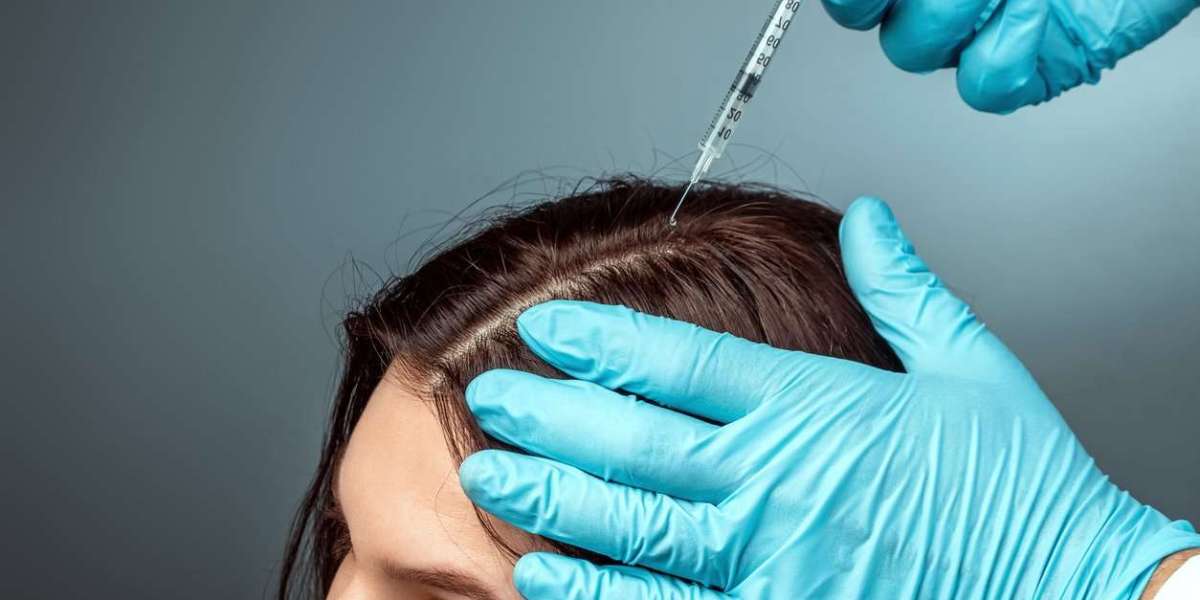 Exosomes Hair Therapy In Islamabad: What Are the Possible Benefits?