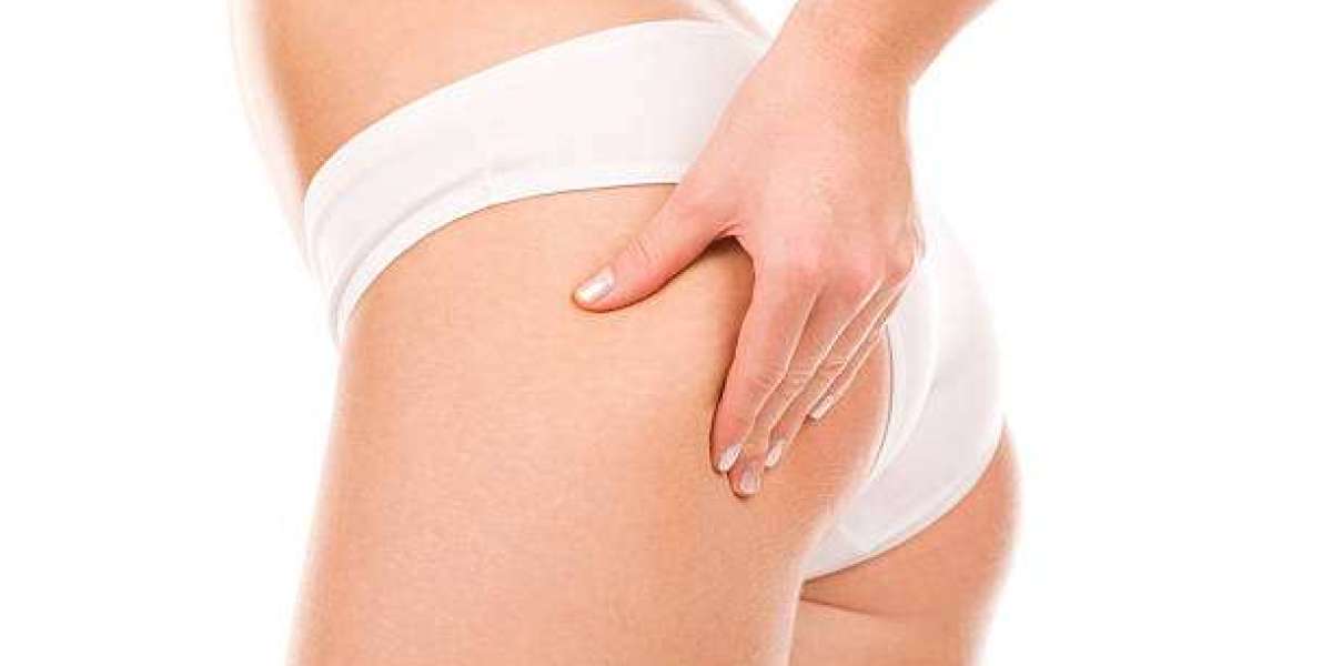Brazilian Butt Lift Facts for Better Patient Awareness