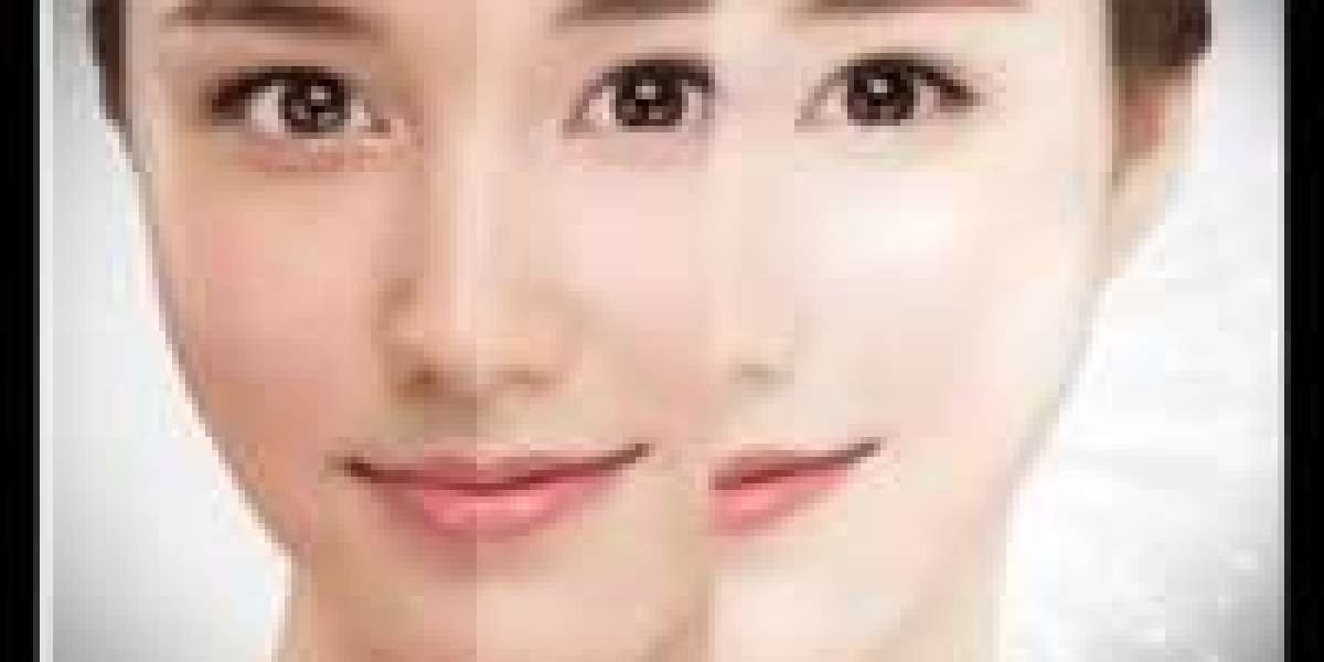 Comprehensive Skin Whitening in Dubai for Balance