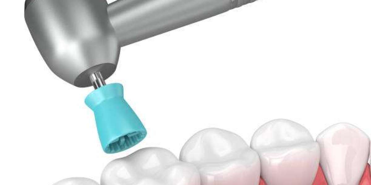 Electric Tooth Polisher Market Trends Transforming Oral Care